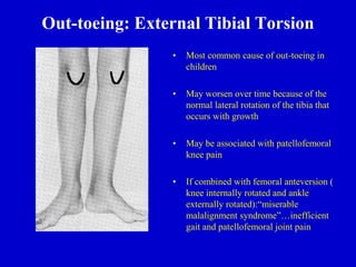Out-toeing: External Tibial Torsion
• Most common cause of out-toeing in
children
• May worsen over time because of the
normal lateral rotation of the tibia that
occurs with growth
• May be associated with patellofemoral
knee pain
• If combined with femoral anteversion (
knee internally rotated and ankle
externally rotated):“miserable
malalignment syndrome”…inefficient
gait and patellofemoral joint pain
 