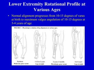 Lower Extremity Rotational Profile at
Various Ages
• Normal alignment progresses from 10-15 degrees of varus
at birth to maximum valgus angulation of 10-15 degrees at
3-4 years of age
 