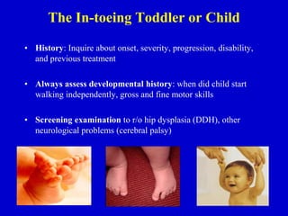 The In-toeing Toddler or Child
• History: Inquire about onset, severity, progression, disability,
and previous treatment
• Always assess developmental history: when did child start
walking independently, gross and fine motor skills
• Screening examination to r/o hip dysplasia (DDH), other
neurological problems (cerebral palsy)
 