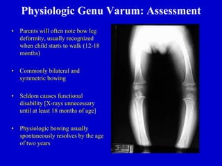 Physiologic Genu Varum: Assessment
• Parents will often note bow leg
deformity, usually recognized
when child starts to walk (12-18
months)
• Commonly bilateral and
symmetric bowing
• Seldom causes functional
disability [X-rays unnecessary
until at least 18 months of age]
• Physiologic bowing usually
spontaneously resolves by the age
of two years
 