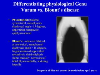 Differentiating physiological Genu
Varum vs. Blount’s disease
• Physiological: bilateral,
symmetrical, metaphyseal-
diaphyseal angle <15 degrees,
upper tibial metaphysis/
epiphysis normal
• Blount’s: unilateral/ bilateral,
asymmetrical, metaphyseal-
diaphyseal angle > 15 degrees,
fragmentation of upper tibial
metaphysis, tibial epiphysis
slopes medially, norrowing of
tibial physis medially, widening
laterally
Diagnosis of Blount’s cannot be made before age 2 years
 