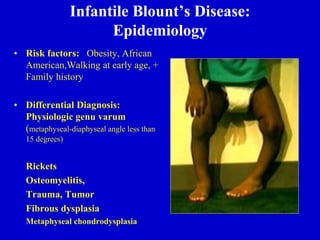 Infantile Blount’s Disease:
Epidemiology
• Risk factors: Obesity, African
American,Walking at early age, +
Family history
• Differential Diagnosis:
Physiologic genu varum
(metaphyseal-diaphyseal angle less than
15 degrees)
Rickets
Osteomyelitis,
Trauma, Tumor
Fibrous dysplasia
Metaphyseal chondrodysplasia
 
