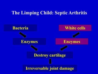 Bacteria
Enzymes
Destroy cartilage
Irreversable joint damage
White cells
Enzymes
The Limping Child: Septic Arthritis
 
