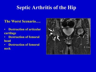 The Worst Scenario….
• Destruction of articular
cartilage
• Destruction of femoral
head
• Destruction of femoral
neck
Septic Arthritis of the Hip
 