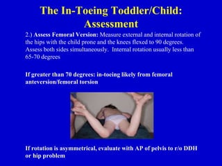 The In-Toeing Toddler/Child:
Assessment
2.) Assess Femoral Version: Measure external and internal rotation of
the hips with the child prone and the knees flexed to 90 degrees.
Assess both sides simultaneously. Internal rotation usually less than
65-70 degrees
If greater than 70 degrees: in-toeing likely from femoral
anteversion/femoral torsion
If rotation is asymmetrical, evaluate with AP of pelvis to r/o DDH
or hip problem
 
