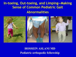 In-toeing, Out-toeing, and Limping—Making
Sense of Common Pediatric Gait
Abnormalities
HOSSEIN ASLANI MD
Pediatric orthopedic fellowship
 