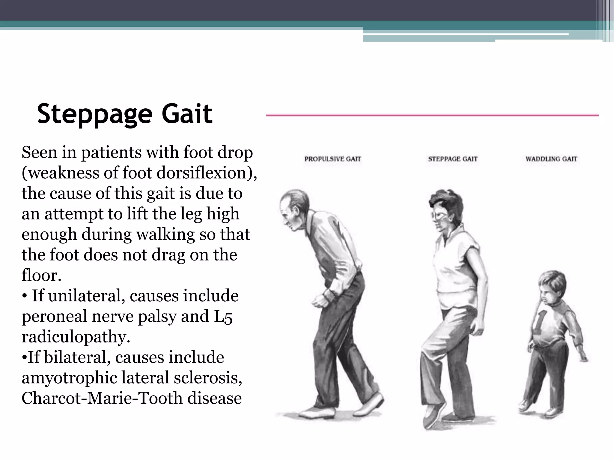 The Forgotten Muscle That Impacts Your Entire Gait - jdgxnrw