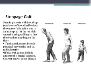 Gait abnormalities presentation