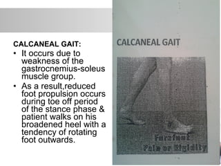 CALCANEAL GAIT:
• It occurs due to
weakness of the
gastrocnemius-soleus
muscle group.
• As a result,reduced
foot propulsion occurs
during toe off period
of the stance phase &
patient walks on his
broadened heel with a
tendency of rotating
foot outwards.
 