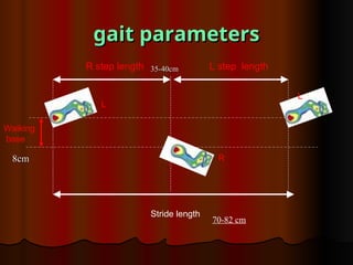 gait parameters
gait parameters
Stride length
L step length
R step length
L
L
R
Walking
base
8cm
8cm
70-82 cm
35-40cm
35-40cm
 