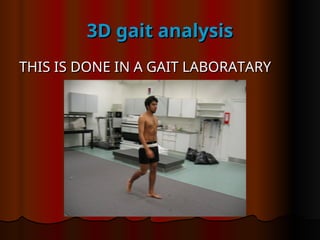 3D gait analysis
3D gait analysis
THIS IS DONE IN A GAIT LABORATARY
THIS IS DONE IN A GAIT LABORATARY
 