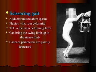 Scissoring gait
Scissoring gait
 Adductor musculature spasm
Adductor musculature spasm
 Flexion +int. rotn deformity
Flexion +int. rotn deformity
 TFL is the main deforming force
TFL is the main deforming force
 Can bring the swing limb up to
Can bring the swing limb up to
the stance limb
the stance limb
 Cadence parameters are grossly
Cadence parameters are grossly
decreased
decreased
 