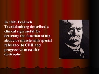 In 1895 Fredrich
Trendelenburg described a
clinical sign useful for
detecting the function of hip
abductor muscle with special
referance to CDH and
progressive muscular
dystrophy
 