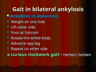 Gait in bilateral ankylosis
Gait in bilateral ankylosis
Ankylosis in abduction
Ankylosis in abduction
 Weight on one side
Weight on one side
 Lift other side
Lift other side
 Foot as fulcrum
Foot as fulcrum
 Rotate the whole body
Rotate the whole body
 Advance opp leg
Advance opp leg
 Repeat on other side
Repeat on other side
‘
‘a curious clockwork gait’–
a curious clockwork gait’– Herbert Sedden
Herbert Sedden
 