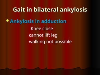 Ankylosis in adduction
Ankylosis in adduction
Knee close
cannot lift leg
walking not possible
Gait in bilateral ankylosis
Gait in bilateral ankylosis
 
