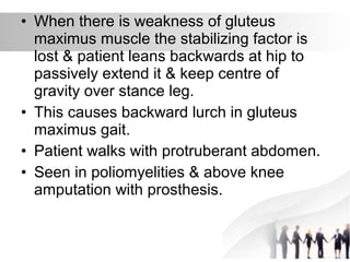 • When there is weakness of gluteus
maximus muscle the stabilizing factor is
lost & patient leans backwards at hip to
passively extend it & keep centre of
gravity over stance leg.
• This causes backward lurch in gluteus
maximus gait.
• Patient walks with protruberant abdomen.
• Seen in poliomyelities & above knee
amputation with prosthesis.
 