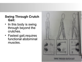 Swing Through Crutch
Gait:
• In this body is swing
through beyond the
crutches.
• Fastest gait,requires
functional abdominal
muscles.
 