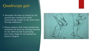 Quadriceps gait
 Normally the knee is locked by the
quadriceps contraction while
transmitting weight to the lower limb
During midstance.
 Hence patient with weak quadriceps
stabilizes his knee by leaning forward
on the affected side & pressing
over lower thigh by his Ipsilateral
hand or fingers.
 