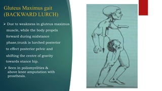Gluteus Maximus gait
(BACKWARD LURCH)
 Due to weakness in gluteus maximus
muscle, while the body propels
forward during midstance
phase,trunk is lurched posterior
to effect posterior pelvic and
shifting the centre of gravity
towards stance hip.
 Seen in poliomyelities &
above knee amputation with
prosthesis.
 