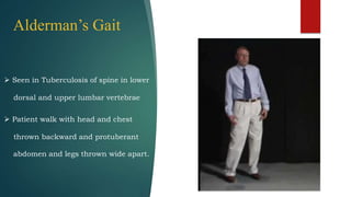 Alderman’s Gait
 Seen in Tuberculosis of spine in lower
dorsal and upper lumbar vertebrae
 Patient walk with head and chest
thrown backward and protuberant
abdomen and legs thrown wide apart.
 