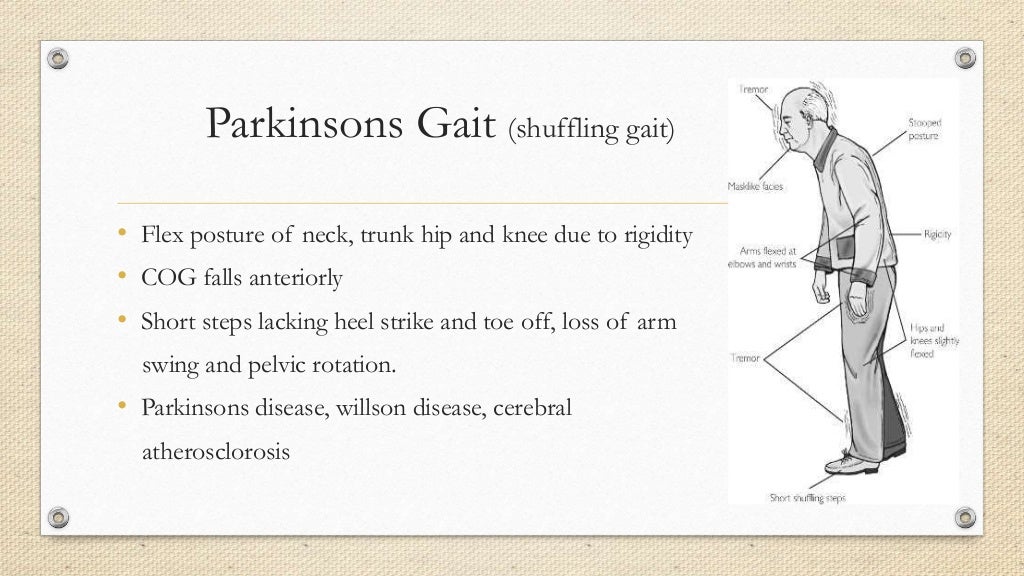 Abnormal Gait abnormal-gait
