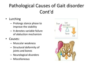 Lurch Examples GAIT and it abnormality by Dr Umar Mohammed NOHIL | PPTX