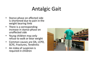 GAIT and it abnormality by Dr Umar Mohammed NOHIL | PPTX