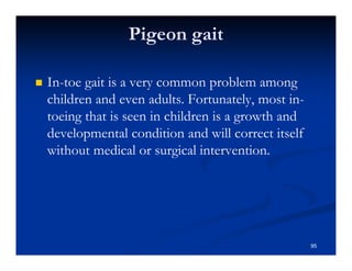 Pigeon gait
In-toe gait is a very common problem among
children and even adults. Fortunately, most in-
toeing that is seen in children is a growth and
developmental condition and will correct itself
without medical or surgical intervention.
95
 