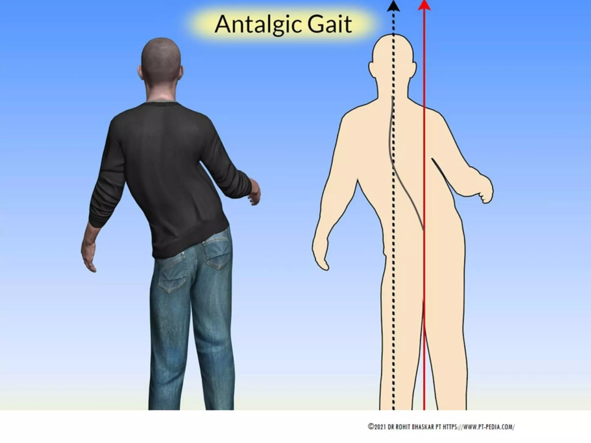 Gait Cycle - Phases & Analysis - Dr Rohit Bhaskar
