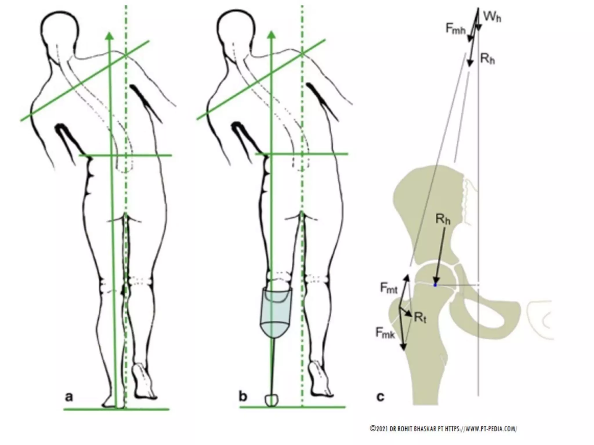 Gait Cycle - Phases & Analysis - Dr Rohit Bhaskar