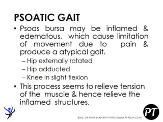 Gait Cycle - Phases & Analysis - Dr Rohit Bhaskar