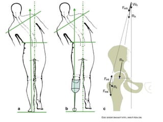 Gait Cycle - Phases & Analysis - Dr Rohit Bhaskar
