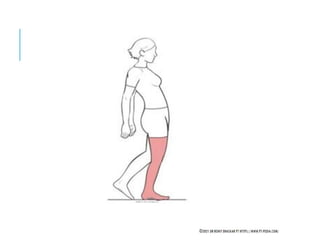 Gait Cycle - Phases & Analysis - Dr Rohit Bhaskar