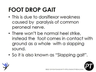 Gait Cycle - Phases & Analysis - Dr Rohit Bhaskar