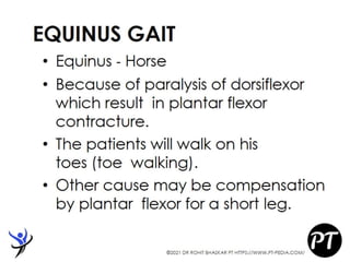 Gait Cycle - Phases & Analysis - Dr Rohit Bhaskar