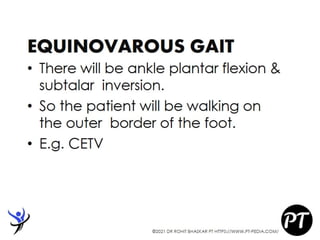Gait Cycle - Phases & Analysis - Dr Rohit Bhaskar