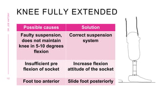 KNEE FULLY EXTENDED
Possible causes Solution
Faulty suspension,
does not maintain
knee in 5-10 degrees
flexion
Correct suspension
system
Insufficient pre
flexion of socket
Increase flexion
attitude of the socket
Foot too anterior Slide foot posteriorly
1 2
DR.
JOE
ANTONY
 