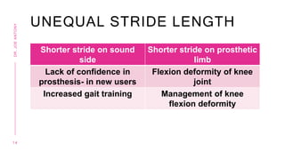 UNEQUAL STRIDE LENGTH
Shorter stride on sound
side
Shorter stride on prosthetic
limb
Lack of confidence in
prosthesis- in new users
Flexion deformity of knee
joint
Increased gait training Management of knee
flexion deformity
1 4
DR.
JOE
ANTONY
 