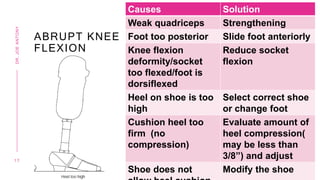 ABRUPT KNEE
FLEXION
Causes Solution
Weak quadriceps Strengthening
Foot too posterior Slide foot anteriorly
Knee flexion
deformity/socket
too flexed/foot is
dorsiflexed
Reduce socket
flexion
Heel on shoe is too
high
Select correct shoe
or change foot
Cushion heel too
firm (no
compression)
Evaluate amount of
heel compression(
may be less than
3/8”) and adjust
Shoe does not Modify the shoe
1 7
DR.
JOE
ANTONY
 