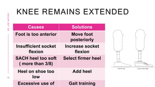 KNEE REMAINS EXTENDED
Causes Solutions
Foot is too anterior Move foot
posteriorly
Insufficient socket
flexion
Increase socket
flexion
SACH heel too soft
( more than 3/8)
Select firmer heel
Heel on shoe too
low
Add heel
Excessive use of Gait training
1 8
DR.
JOE
ANTONY
 