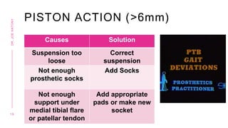 PISTON ACTION (>6mm)
Causes Solution
Suspension too
loose
Correct
suspension
Not enough
prosthetic socks
Add Socks
Not enough
support under
medial tibial flare
or patellar tendon
Add appropriate
pads or make new
socket
1 9
DR.
JOE
ANTONY
 