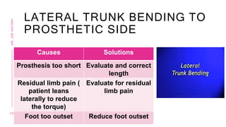 LATERAL TRUNK BENDING TO
PROSTHETIC SIDE
Causes Solutions
Prosthesis too short Evaluate and correct
length
Residual limb pain (
patient leans
laterally to reduce
the torque)
Evaluate for residual
limb pain
Foot too outset Reduce foot outset
2 5
DR.
JOE
ANTONY
 