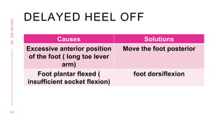 DELAYED HEEL OFF
2 9
DR.
JOE
ANTONY
Causes Solutions
Excessive anterior position
of the foot ( long toe lever
arm)
Move the foot posterior
Foot plantar flexed (
insufficient socket flexion)
foot dorsiflexion
 