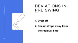 DEVIATIONS IN
PRE SWING
1. Drop off
2. Socket drops away from
the residual limb
3 1
DR.
JOE
ANTONY
 