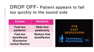 DROP OFF- Patient appears to fall
too quickly to the sound side
Causes Solutions
Foot too
posterior
Slide foot
posteriorly
Foot too
dorsiflexed
(Excessive
socket flexion)
Reduce foot
dorsiflexion
3 2
DR.
JOE
ANTONY
 