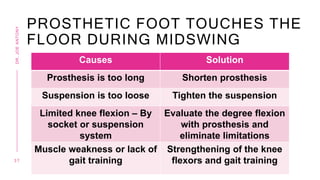 PROSTHETIC FOOT TOUCHES THE
FLOOR DURING MIDSWING
Causes Solution
Prosthesis is too long Shorten prosthesis
Suspension is too loose Tighten the suspension
Limited knee flexion – By
socket or suspension
system
Evaluate the degree flexion
with prosthesis and
eliminate limitations
Muscle weakness or lack of
gait training
Strengthening of the knee
flexors and gait training
3 7
DR.
JOE
ANTONY
 
