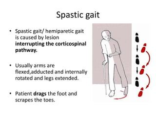 Spastic gait
• Spastic gait/ hemiparetic gait
is caused by lesion
interrupting the corticospinal
pathway.
• Usually arms are
flexed,adducted and internally
rotated and legs extended.
• Patient drags the foot and
scrapes the toes.
 
