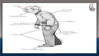 Gait in elderly