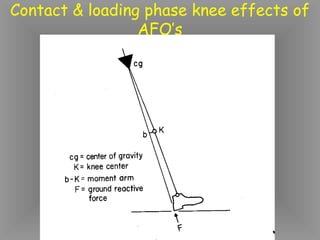 Contact & loading phase knee effects of
                 AFO’s
 