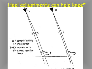 Heel adjustments can help knee*
 